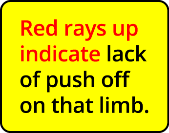 Red rays up indicate lack of push off on that limb  