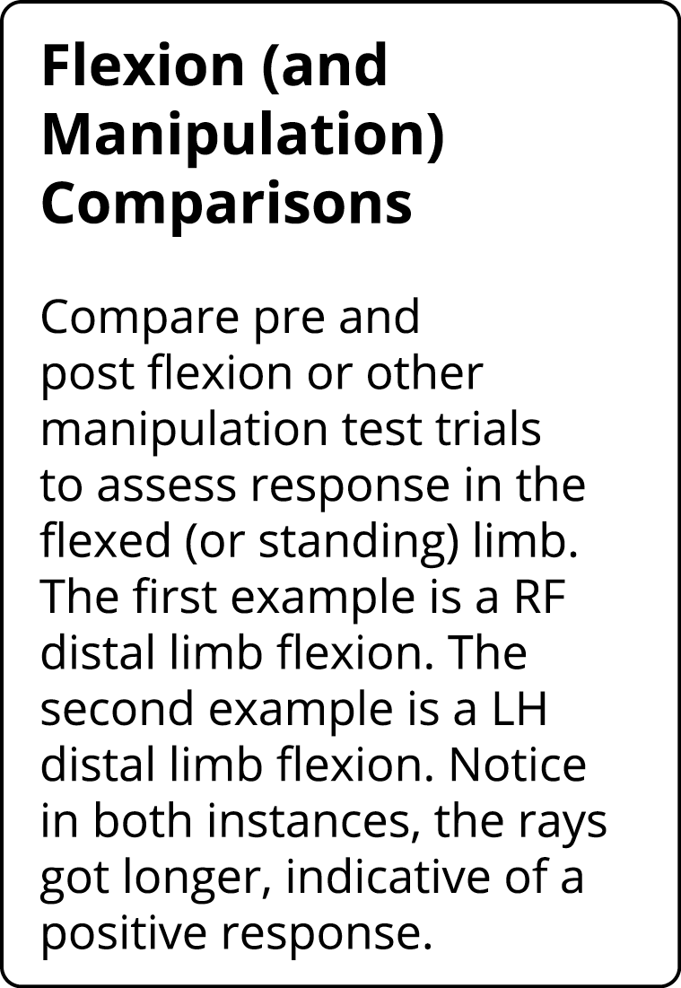 Flexion (and Manipulation) Comparisons Compare pre and post flexion or other manipulation test trials to assess respo   